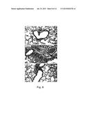 Method of Using Attenuated Bordetella Strains diagram and image