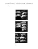 CONJUGATE OF A PHOTOSENSITISER AND CHITOSAN AND USES THEREOF diagram and image