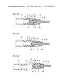 MEDICAL SAFETY NEEDLE PREVENTIVE OF NEEDLEPOINT RE-EXPOSURE diagram and image