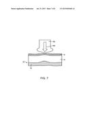 Apparatus for Treating Cellulite diagram and image