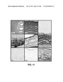 METHODS OF ISOLATING AND CULTURING STEM CELLS diagram and image