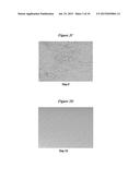 EXOSOMES AND MICRO-RIBONUCLEIC ACIDS FOR TISSUE REGENERATION diagram and image