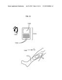 DORMANT TO ACTIVE APPURTENANCES FOR REPORTING INFORMATION REGARDING WOUND     DRESSINGS diagram and image