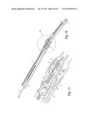 SURGICAL APPARATUS diagram and image