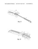 SURGICAL APPARATUS diagram and image