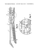 SURGICAL APPARATUS diagram and image