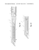 SURGICAL APPARATUS diagram and image