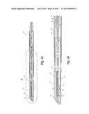 SURGICAL APPARATUS diagram and image