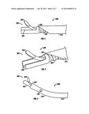 SURGICAL DISC REMOVAL TOOL diagram and image