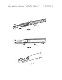 SURGICAL DISC REMOVAL TOOL diagram and image