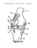 KNEE HINGE FIXATION APPARATUS AND METHOD FOR APPLICATION THEREOF diagram and image