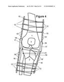 KNEE HINGE FIXATION APPARATUS AND METHOD FOR APPLICATION THEREOF diagram and image