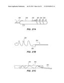 SYSTEM AND METHOD FOR ENDOLUMINAL AND TRANSLUMENAL THERAPY diagram and image