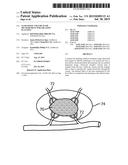 ULTRASONIC VOLUME FLOW MEASUREMENT FOR ABLATION PLANNING diagram and image