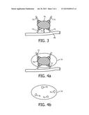 ULTRASONIC VOLUME FLOW MEASUREMENT FOR ABLATION PLANNING diagram and image