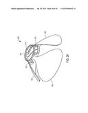 MEDICAL DEVICES AND DELIVERY SYSTEMS FOR DELIVERING MEDICAL DEVICES diagram and image