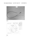 MRI COMPATIBLE ABLATION CATHETER SYSTEM INCORPORATING DIRECTIONAL     HIGH-INTENSITY ULTRASOUND FOR TREATMENT diagram and image