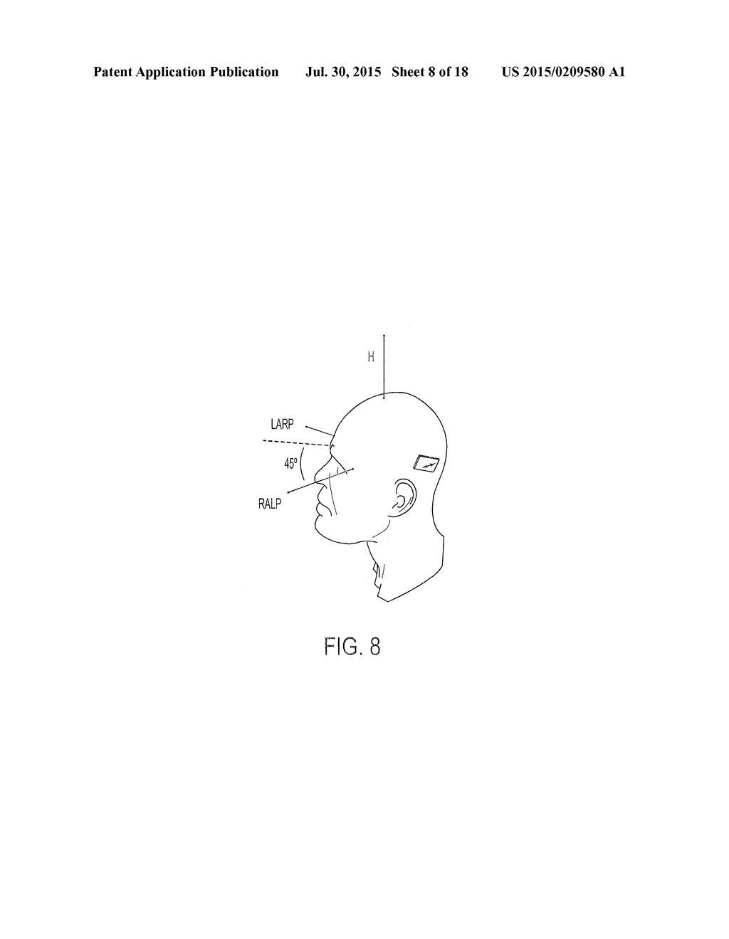 IMPLANTABLE VESTIBULAR PROSTHESIS - diagram, schematic, and image 09