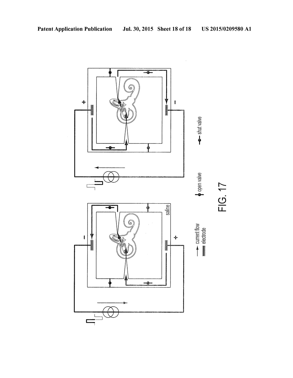 IMPLANTABLE VESTIBULAR PROSTHESIS - diagram, schematic, and image 19