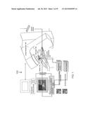 MANIPULATION OF IMAGING PROBE DURING MEDICAL PROCEDURE diagram and image