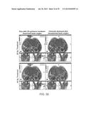 MANIPULATION OF IMAGING PROBE DURING MEDICAL PROCEDURE diagram and image