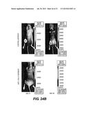 DETECTING CANCER WITH ANTI-CXCL13 AND ANTI-CXCR5 ANTIBODIES diagram and image