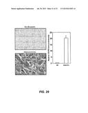 DETECTING CANCER WITH ANTI-CXCL13 AND ANTI-CXCR5 ANTIBODIES diagram and image