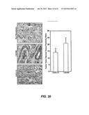 DETECTING CANCER WITH ANTI-CXCL13 AND ANTI-CXCR5 ANTIBODIES diagram and image