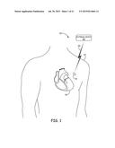 IMPLANTABLE MEDICAL DEVICES HAVING COFIRE CERAMIC MODULES AND METHODS OF     FABRICATING THE SAME diagram and image