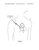 IMPLANTABLE MEDICAL DEVICES HAVING COFIRE CERAMIC MODULES AND METHODS OF     FABRICATING THE SAME diagram and image