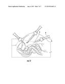 LAPAROSCOPE diagram and image