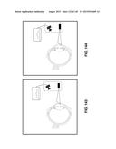 Methods And Apparatuses For Providing Laser Scanning Applications diagram and image