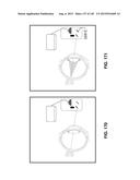 Methods And Apparatuses For Providing Laser Scanning Applications diagram and image