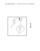 Methods And Apparatuses For Providing Laser Scanning Applications diagram and image