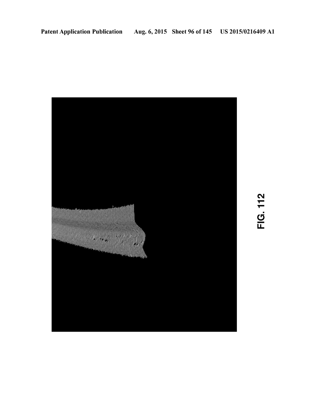 Methods And Apparatuses For Providing Laser Scanning Applications - diagram, schematic, and image 97