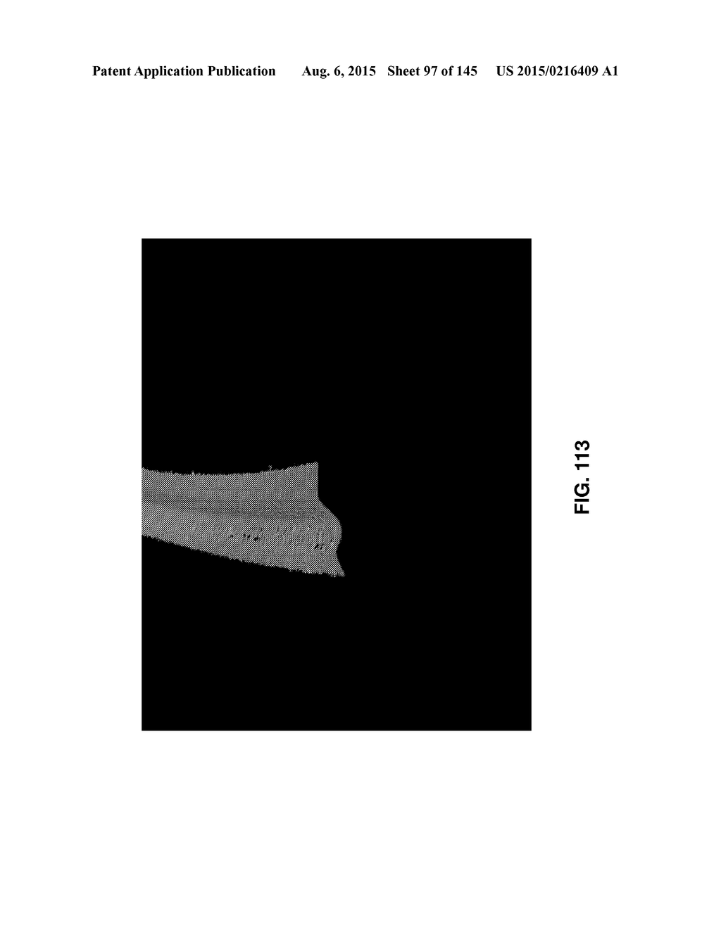 Methods And Apparatuses For Providing Laser Scanning Applications - diagram, schematic, and image 98