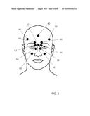 METHOD FOR DIAGNOSING SELECTED CONDITIONS USING THERMOGRAPHY diagram and image