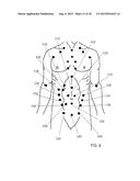 METHOD FOR DIAGNOSING SELECTED CONDITIONS USING THERMOGRAPHY diagram and image