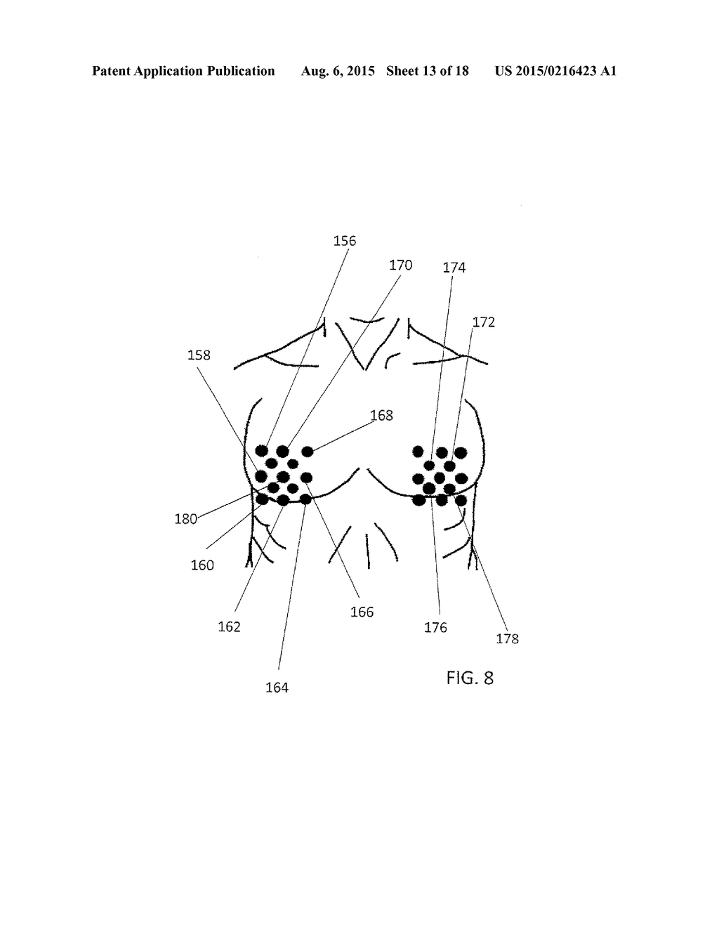 METHOD FOR DIAGNOSING SELECTED CONDITIONS USING THERMOGRAPHY - diagram, schematic, and image 14