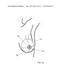 METHOD FOR DIAGNOSING SELECTED CONDITIONS USING THERMOGRAPHY diagram and image