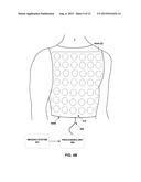 ASSESSING INTRA-CARDIAC ACTIVATION PATTERNS diagram and image