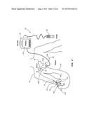 Systems and Methods for Guidance and Placement of an Intravascular Device diagram and image