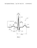 Systems and Methods for Guidance and Placement of an Intravascular Device diagram and image