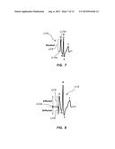 Systems and Methods for Guidance and Placement of an Intravascular Device diagram and image