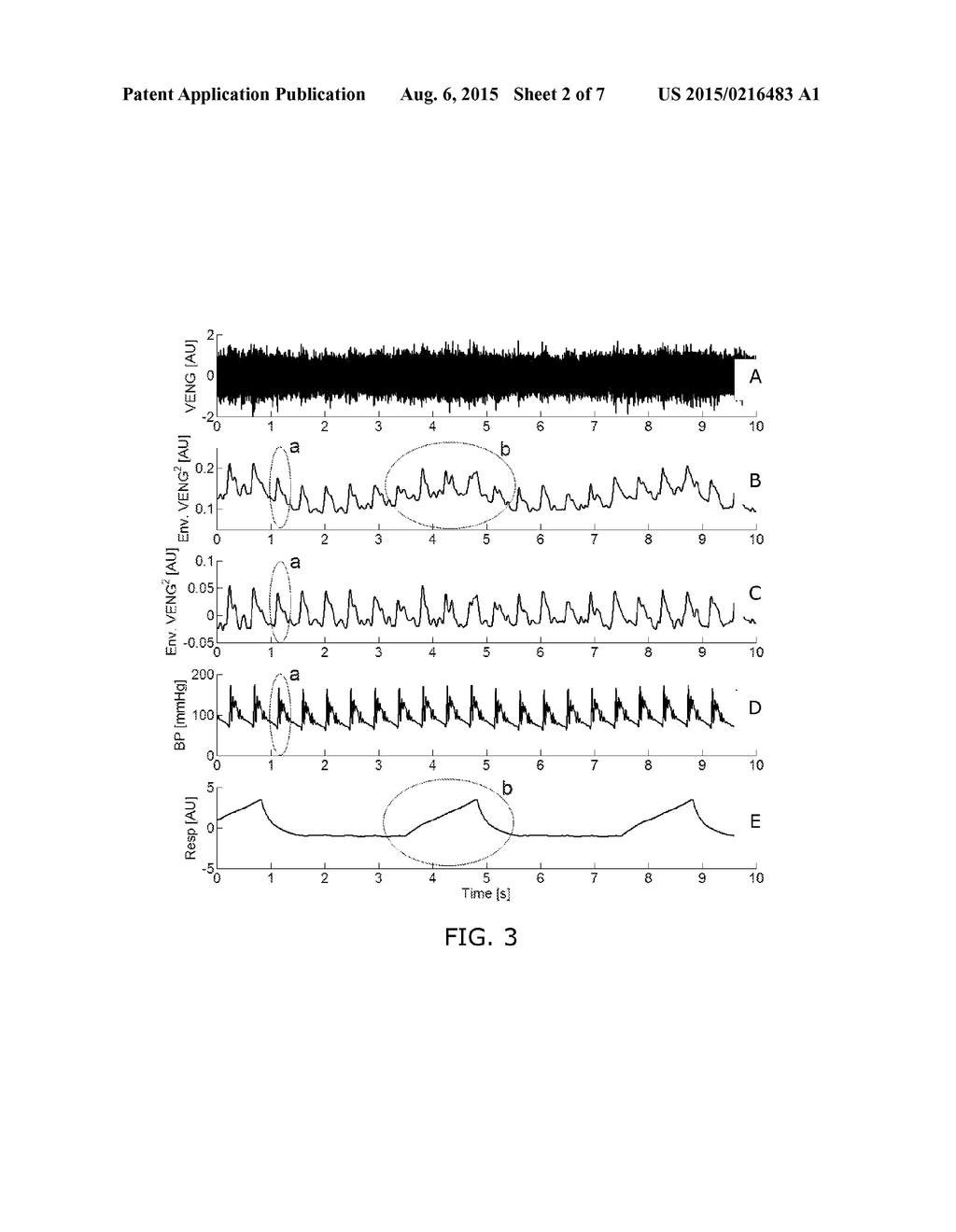 BLOOD PRESSURE ESTIMATION BASED ON NEURAL ACTIVITY - diagram, schematic, and image 03