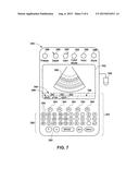 METHODS AND SYSTEMS FOR DATA COMMUNICATION IN AN ULTRASOUND SYSTEM diagram and image