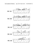 SURGICAL INCISION AND CLOSURE APPARATUS diagram and image