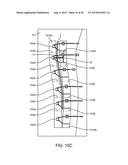 SURGICAL INCISION AND CLOSURE APPARATUS diagram and image