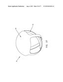 METHOD AND APPARATUS FOR RESTRICTING FLOW THROUGH AN OPENING IN THE SIDE     WALL OF A BODY LUMEN, AND/OR FOR REINFORCING A WEAKNESS IN THE SIDE WALL     OF A BODY LUMEN, WHILE STILL MAINTAINING SUBSTANTIALLY NORMAL FLOW     THROUGH THE BODY LUMEN diagram and image