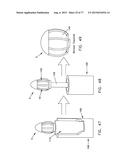 METHOD AND APPARATUS FOR RESTRICTING FLOW THROUGH AN OPENING IN THE SIDE     WALL OF A BODY LUMEN, AND/OR FOR REINFORCING A WEAKNESS IN THE SIDE WALL     OF A BODY LUMEN, WHILE STILL MAINTAINING SUBSTANTIALLY NORMAL FLOW     THROUGH THE BODY LUMEN diagram and image